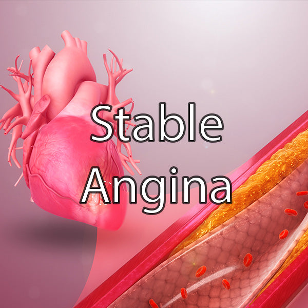 Stable Angina